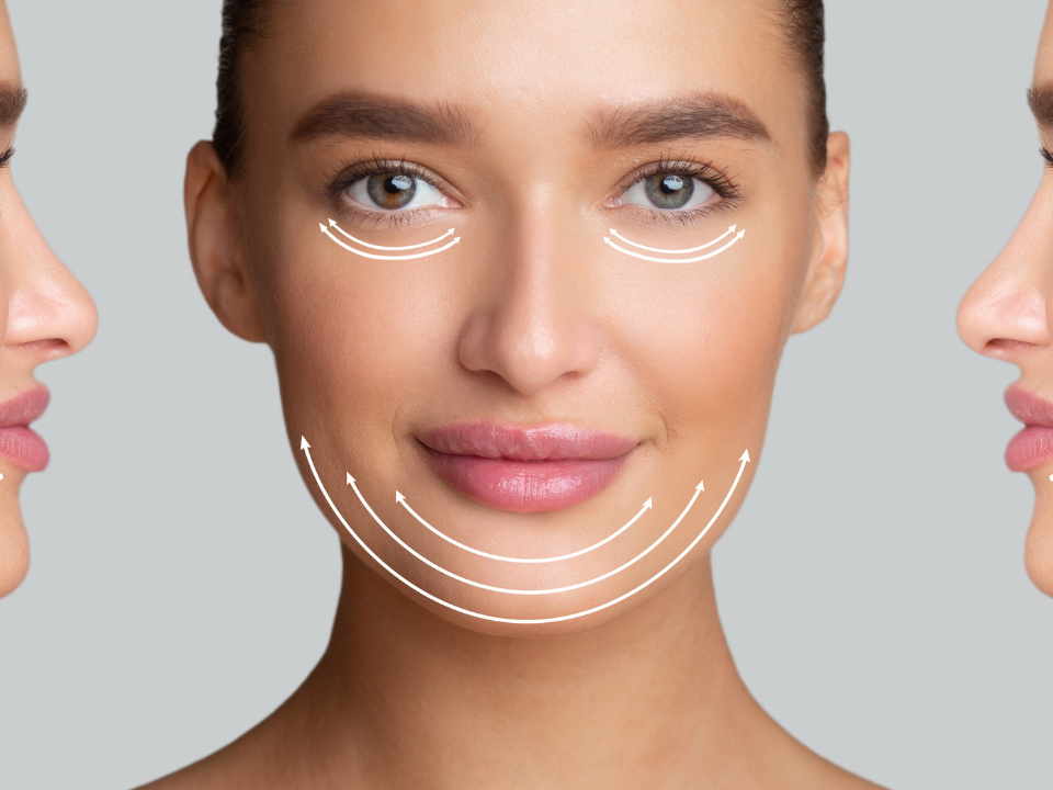 Lifting Facial - Dr. Ricardo Maniglia em Curitiba